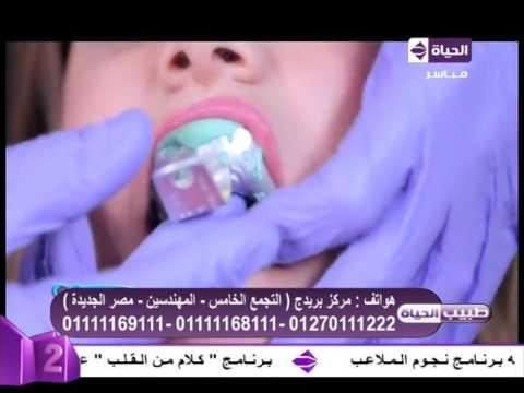 تقرير عن تركيب قشرة تجميلية لحالة حية