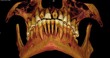   مصر اليوم - العثور على مومياء مصرية أسنانها محشوة بالكتان لعلاج الآلام